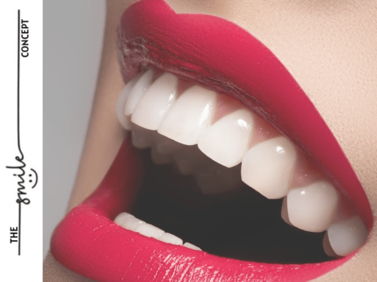 Embrace a Radiant Smile: Making Dental Care Your New Year’s Resolution
